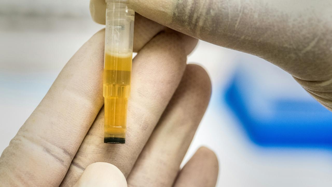 Oppdatering Cystinuri